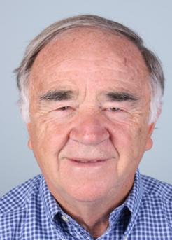 Before Hair Transplant&nbsp;Front
